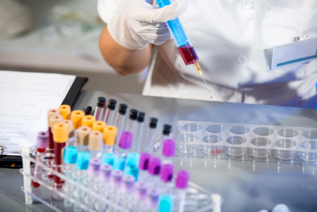 lab tests