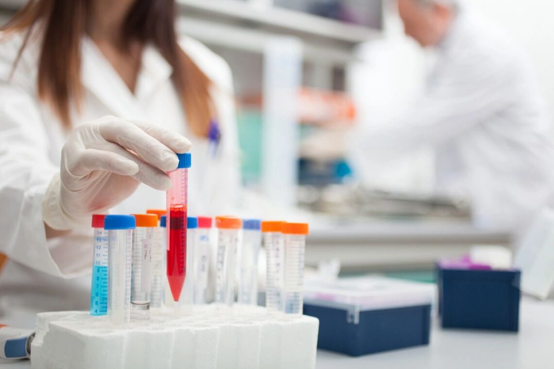 lab vials