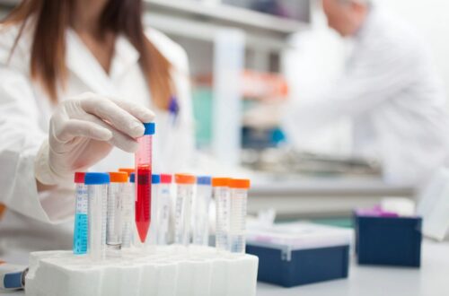lab vials