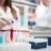 lab vials